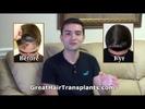 Dr Brett  Bolton Review