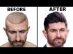 Gary Linkov's Linkov Hair Surgery business reviews, Photos , videos and Updates