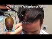 Dr Brett  Bolton's Great Hair Transplants business reviews, Photos , videos and Updates
